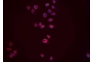 ABIN6276553 staining Hela cells by IF/ICC. (DUSP6 抗体  (Internal Region))