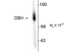 Western blots of human adrenal medulla lysate showing specific immunolabeling of the ~75k DBH protein. (DBH 抗体  (N-Term))