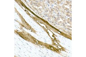 Immunohistochemistry (IHC) image for anti-Collagen, Type I, alpha 1 (COL1A1) (AA 100-200) antibody (ABIN6138837)
