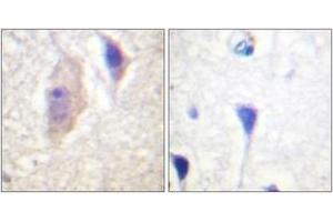 Immunohistochemistry analysis of paraffin-embedded human brain, using Bcr (Phospho-Tyr360) Antibody. (BCR 抗体  (pTyr360))
