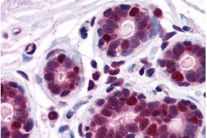 ABIN185199 (2. (DDX5 抗体  (C-Term))