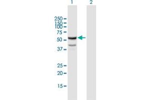 Western Blot analysis of CYP11B1 expression in transfected 293T cell line by CYP11B1 MaxPab polyclonal antibody. (CYP11B1 抗体  (AA 1-574))