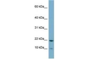 Image no. 1 for anti-Desumoylating Isopeptidase 1b (DESI1B) (C-Term) antibody (ABIN6741787) (DESI1 / PPPDE2 抗体  (C-Term))