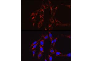 Immunofluorescence (IF) image for anti-SECIS Binding Protein 2 (SECISBP2) (AA 585-854) antibody (ABIN6147497)