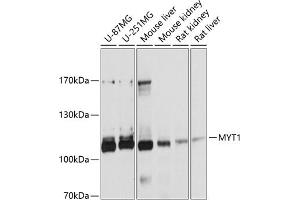 Western blot analysis of extracts of various cell lines, using MYT1 antibody (ABIN6129057, ABIN6144304, ABIN6144305 and ABIN6215004) at 1:1000 dilution. (MYT1 抗体  (AA 650-820))