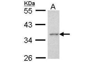 WB Image Sample (30 ug of whole cell lysate) A: Hela 10% SDS PAGE antibody diluted at 1:1000 (AEN 抗体  (C-Term))