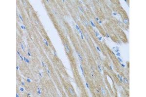Immunohistochemistry of paraffin-embedded Mouse heart using CCM2 Polyclonal Antibody at dilution of 1:100 (40x lens). (CCM2 抗体)