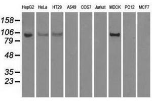 Image no. 3 for anti-Hexokinase 2 (HK2) antibody (ABIN1498647) (Hexokinase 2 抗体)