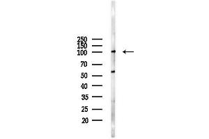 anti-TEL2, Telomere Maintenance 2, Homolog (TELO2) (Internal Region) antibody
