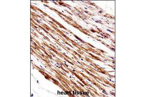 Immunohistochemistry (Formalin/PFA-fixed paraffin-embedded sections) of human heart tissue with PLA2G5 polyclonal antibody  followed by peroxidase conjugation of the secondary antibody and DAB staining. (PLA2G5 抗体  (AA 103-132))