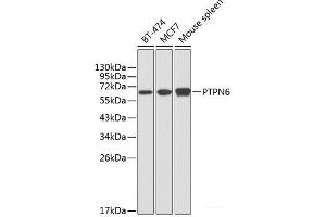Western blot analysis of extracts of various cell lines using PTPN6 Polyclonal Antibody at dilution of 1:1000. (SHP1 抗体)