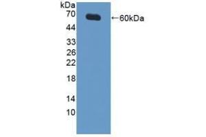 Detection of Recombinant XIAP, Human using Polyclonal Antibody to X-linked Inhibitor Of Apoptosis Protein (XIAP) (XIAP 抗体  (AA 1-497))
