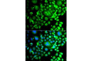 Immunofluorescence analysis of A549 cells using SNX3 antibody (ABIN6290935). (Sorting Nexin 3 抗体)