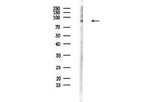 Western blot analysis of lysates from Hela cells(heat-shock,45 min treatment), using GI Antibody at 1/1000 dilution.