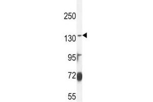 ABCC3 antibody western blot analysis in MDA-MB435 lysate (ABCC3 抗体  (AA 899-925))