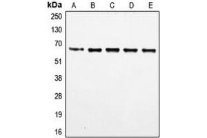 Western blot analysis of FOXO4 (pS197) expression in HeLa (A), MM142 (B), HuT78 (C), HEK293T (D), NIH3T3 (E) whole cell lysates. (FOXO4 抗体  (pSer197))