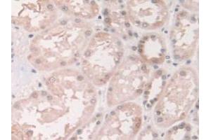 IHC-P analysis of Human Kidney Tissue, with DAB staining. (Grancalcin 抗体  (AA 1-139))