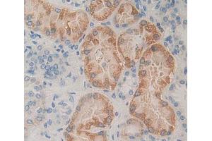IHC-P analysis of kidney tissue, with DAB staining. (PLTP 抗体  (AA 337-479))