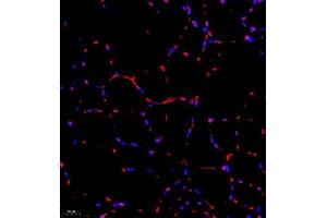 Immunofluorescence of paraffin embedded mouse Skeletal muscle using RB1 (ABIN7075477) at dilution of 1:1400 (400x lens) (RBM45 抗体)