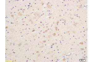 Formalin-fixed and paraffin embedded rat brain labeled with Anti phospho-B-Raf (Ser365) Polyclonal Antibody, Unconjugated (ABIN682888) at 1:200 followed by conjugation to the secondary antibody and DAB staining (SNRPE 抗体  (pSer365))