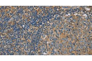 Immunohistochemistry of paraffin-embedded Human tonsil using CLIC1 Polyclonal Antibody at dilution of 1:30 (CLIC1 抗体)