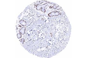 Breast Caldesmon h staining of myoepithelial cells Caldesmon h immunohistochemistry (Recombinant Caldesmon 抗体)