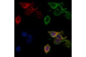 ABIN6260492 and ABIN6268884 staining HepG2 by IF/ICC. (CTNNA1 抗体  (C-Term))