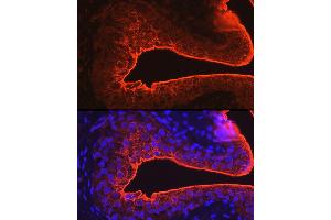 Immunofluorescence analysis of rat bladder using UPK3A Rabbit pAb (ABIN6128904, ABIN6149950, ABIN6149951 and ABIN6214142) at dilution of 1:100 (40x lens). (Uroplakin 3A 抗体  (AA 19-207))
