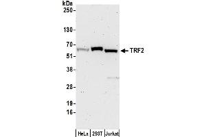 Western Blotting (WB) image for anti-TBP-Like 1 (TBPL1) (AA 375-425) antibody (ABIN7452114)