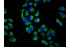 Immunofluorescence staining of Hela cells with ABIN7151301 at 1:200, counter-stained with DAPI. (Zinc Finger Protein 650 (ZNF650) (AA 960-1113) 抗体)