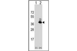 Image no. 5 for anti-Aspartoacylase (ASPA) (AA 89-118), (N-Term) antibody (ABIN452768) (ASPA 抗体  (N-Term))