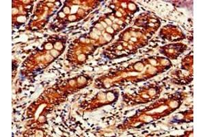 Immunohistochemistry (IHC) image for anti-Signal Transducer and Activator of Transcription 4 (STAT4) (AA 569-748) antibody (ABIN7169681)