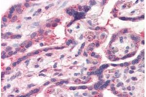 Human Placenta (formalin-fixed, paraffin-embedded) stained with TFF2 antibody ABIN351426 at 15 ug/ml followed by biotinylated goat anti-rabbit IgG secondary antibody ABIN481713, alkaline phosphatase-streptavidin and chromogen. (Trefoil Factor 2 抗体  (Internal Region))
