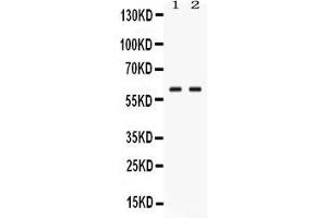 Western blot analysis of GPI expression in human placenta extract ( Lane 1) and JURKAT whole cell lysates ( Lane 2). (GPI 抗体  (N-Term))