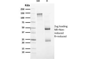 Western Blotting (WB) image for anti-Paired Box 8 (PAX8) (AA 60-261) antibody (ABIN6940923)