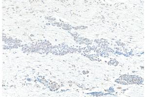 Immunohistochemistry (IHC) image for anti-TAF1 RNA Polymerase II, TATA Box Binding Protein (TBP)-Associated Factor, 250kDa (TAF1) (AA 1750-1800) antibody (ABIN7453573)