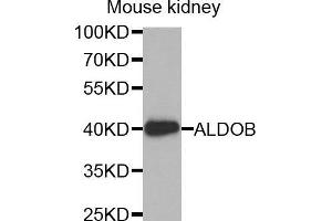 Western Blotting (WB) image for anti-Aldolase B, Fructose-Bisphosphate (ALDOB) (AA 1-200) antibody (ABIN1678634) (ALDOB 抗体  (AA 1-200))