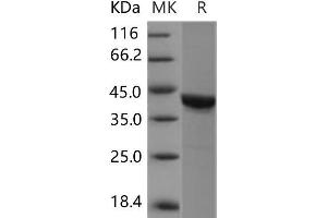 Western Blotting (WB) image for Casein Kinase 2 alpha 1 (CSNK2A1) protein (ABIN7320134) (CSNK2A1/CK II alpha 蛋白)