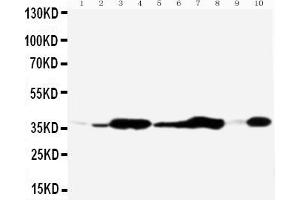 Anti-Annexin V antibody, Western blottingAll lanes: Anti Annexin V  at 0.