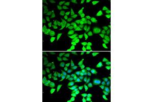 Immunofluorescence analysis of MCF-7 cells using HDAC7 antibody. (HDAC7 抗体)
