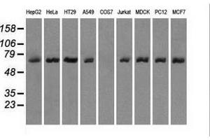 Western blot analysis of extracts (35 µg) from 9 different cell lines by using anti-LTA4H monoclonal antibody. (LTA4H 抗体)