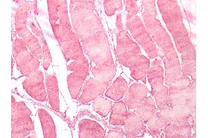 Human Skeletal Muscle: Formalin-Fixed, Paraffin-Embedded (FFPE) (NMUR2 抗体  (N-Term))