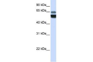 SMPD1 antibody used at 1 ug/ml to detect target protein. (SMPD1 抗体  (Middle Region))