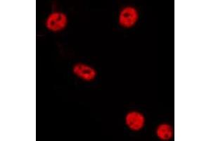 ABIN6275549 staining HepG2 by IF/ICC. (PPP2R3B 抗体  (Internal Region))