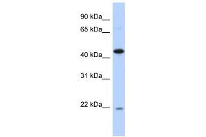 Western Blotting (WB) image for anti-RNA-Binding Protein NOB1 (NOB1) antibody (ABIN2459838) (NOB1 抗体)