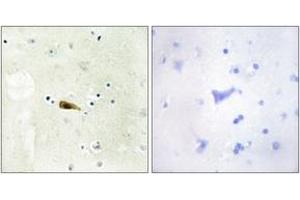 Immunohistochemistry analysis of paraffin-embedded human brain tissue, using MYST1 Antibody. (MYST1 抗体  (AA 101-150))