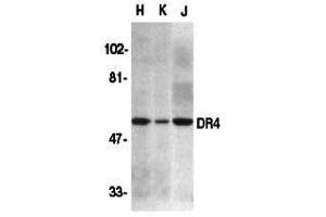 Western Blotting (WB) image for anti-Drought-Repressed 4 Protein (DR4) (N-Term) antibody (ABIN1031359) (DR4 抗体  (N-Term))