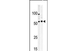 Western blot analysis of anti-PKMYT1 Pabin A375(left) and Y79 (right)cell line lysate. (MYT1 抗体  (C-Term))