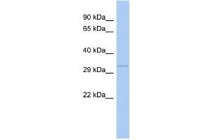 GNB1 antibody used at 1 ug/ml to detect target protein. (GNB1 抗体)