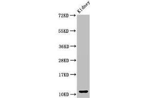 Western Blot Positive WB detected in: Mouse kidney tissue All lanes: CCL3 antibody at 3 μg/mL Secondary Goat polyclonal to rabbit IgG at 1/50000 dilution Predicted band size: 11 kDa Observed band size: 11 kDa (CCL3 抗体  (AA 25-81))